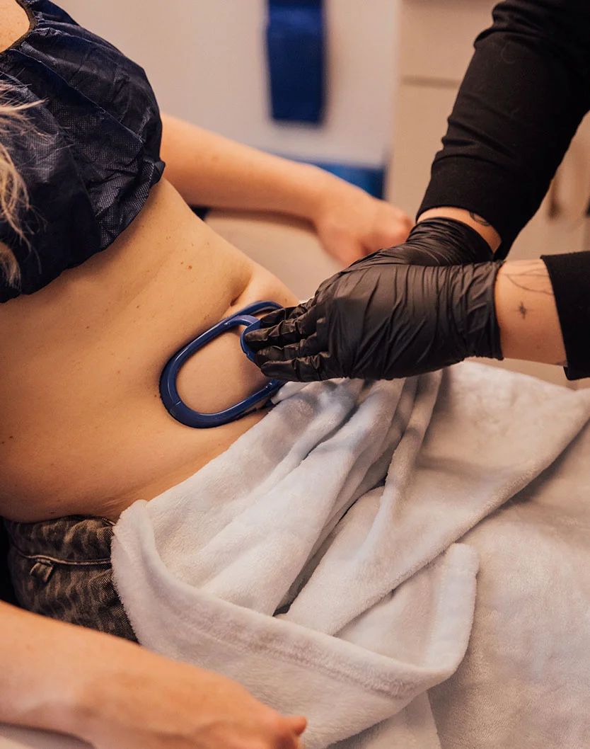 A woman lies on a treatment table wearing a black disposable smock, receiving a body contouring treatment. A person wearing black medical gloves is applying a light-blue device, likely vacuum-based, to the woman's midsection. A white plush blanket covers her upper body and lower torso. The setting is a spa or medical clinic, and the woman appears relaxed. - Coolsculpting in Fairfax, VA