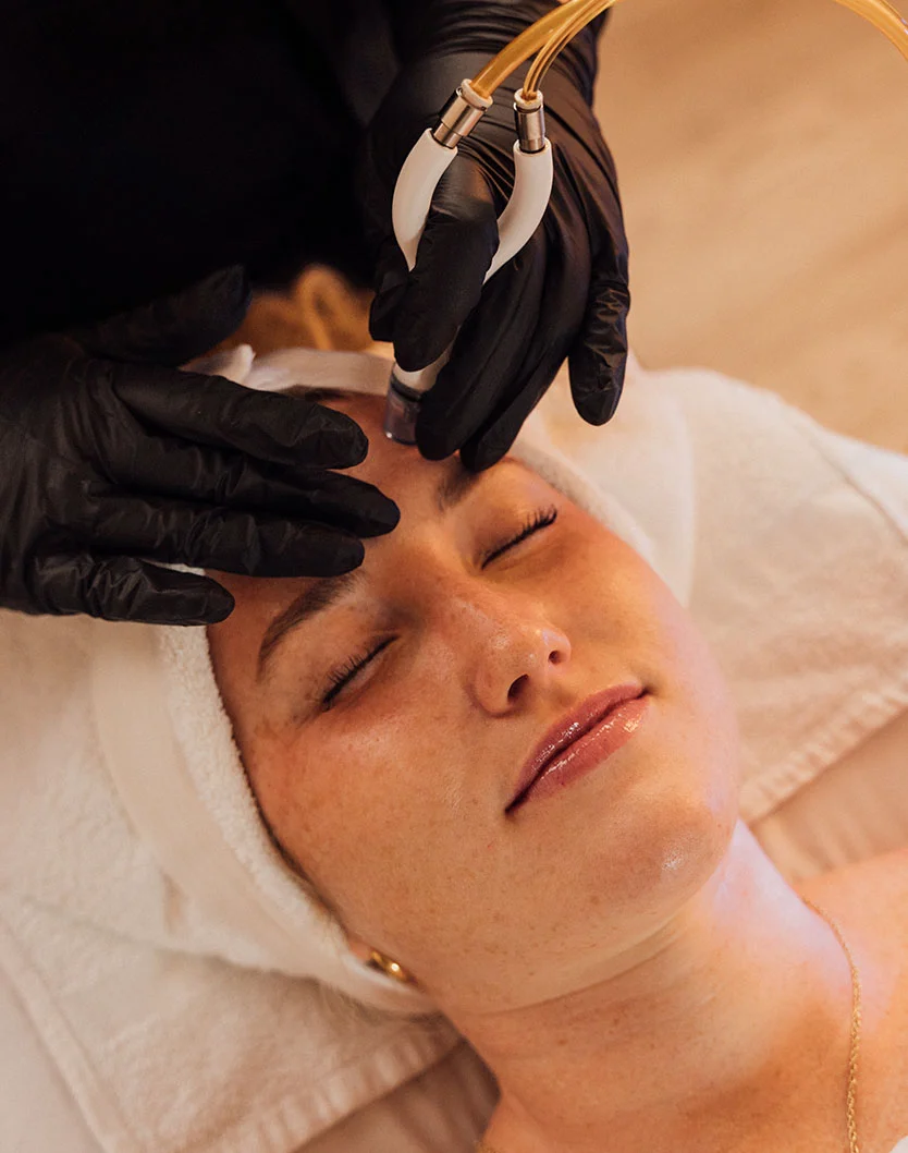 High-angle close-up of a woman receiving a facial treatment on a cream-colored table. She lies with eyes closed and mouth slightly parted, wearing a white towel over her head. A practitioner wearing black gloves uses a white and gold facial vacuum device over her forehead and brow area. Her skin shows light freckles and appears smooth, with soft, ambient lighting. - Diamond Glow Facial in Fairfax, VA