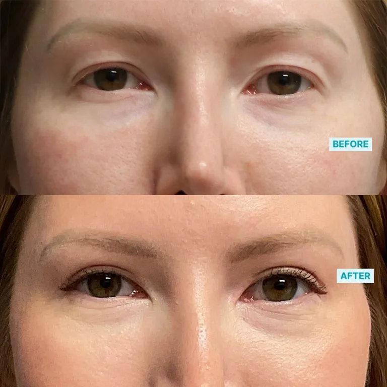 p085-1-768×768-4700